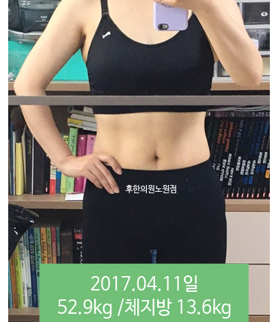 치료 후