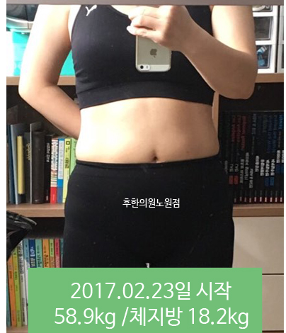 치료 전