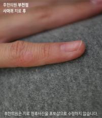 전후사진