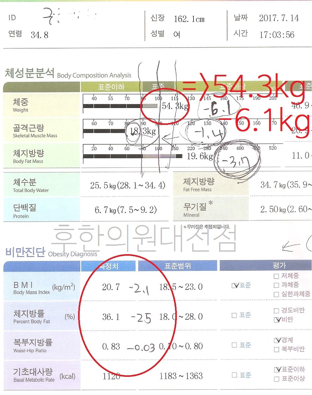 전후사진