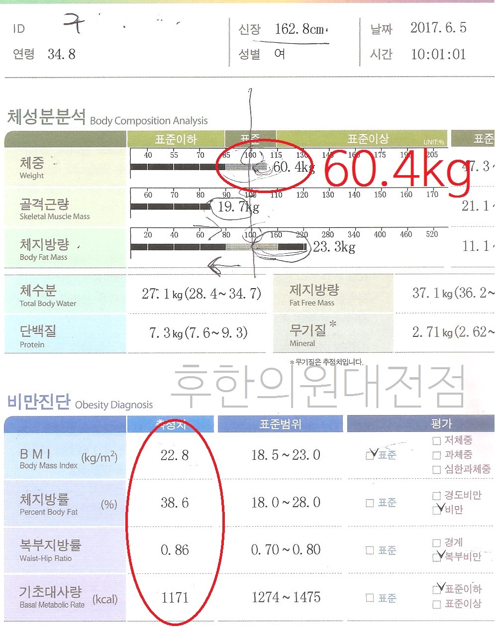 전후사진