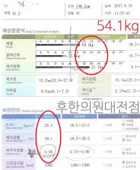 치료 전