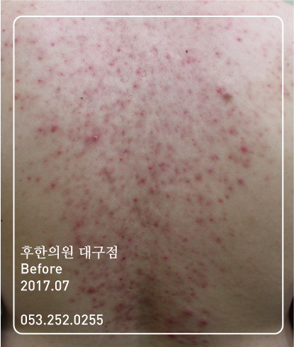 전후사진