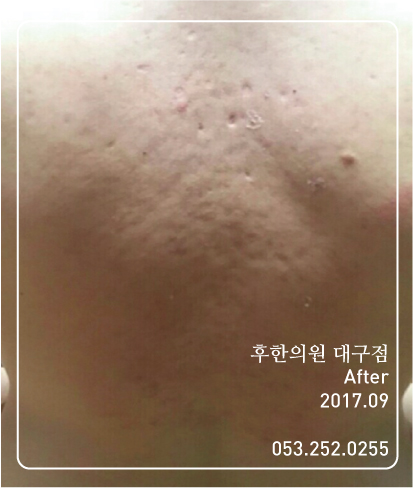 전후사진