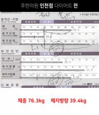 치료 전