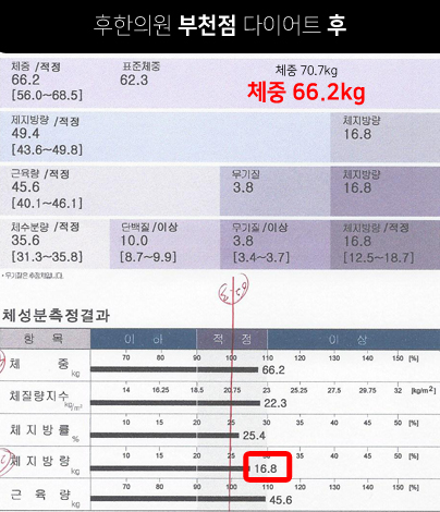 전후사진