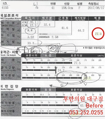 전후사진