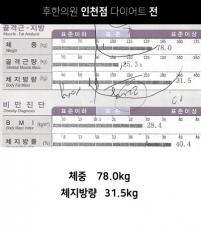 치료 전