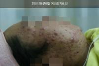 전후사진