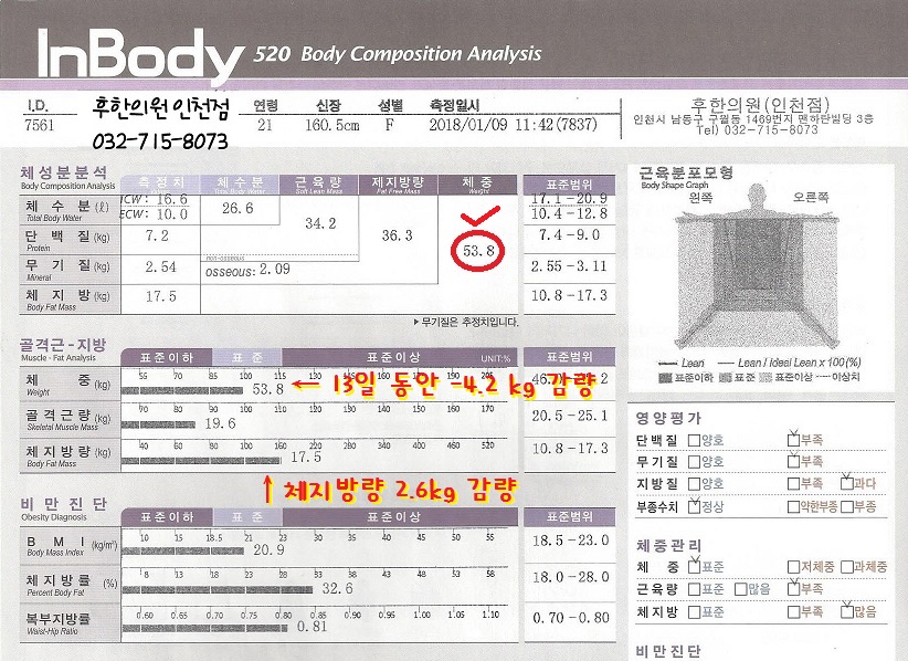 전후사진