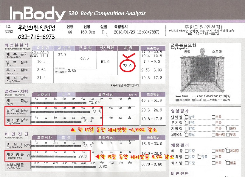 전후사진