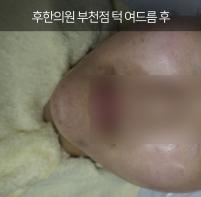 전후사진