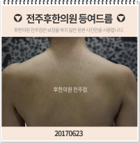 치료 후