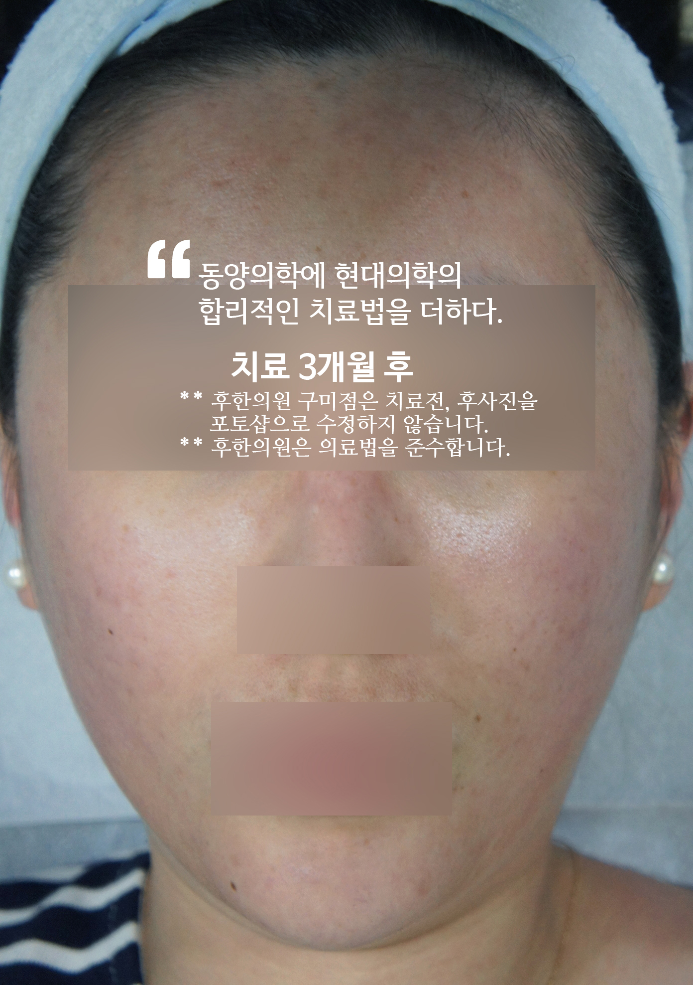 전후사진