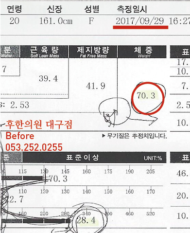 전후사진