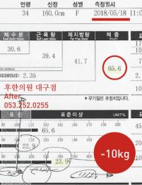 치료 후