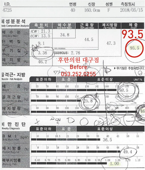 전후사진