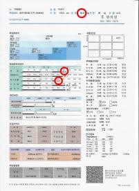 전후사진