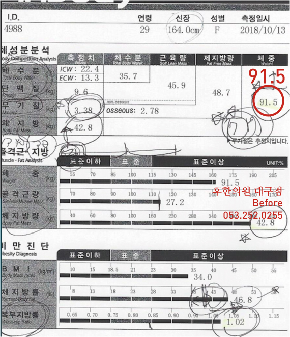 전후사진