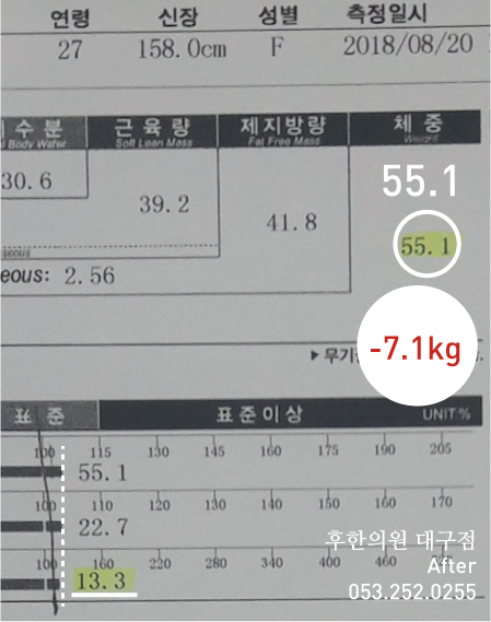 전후사진