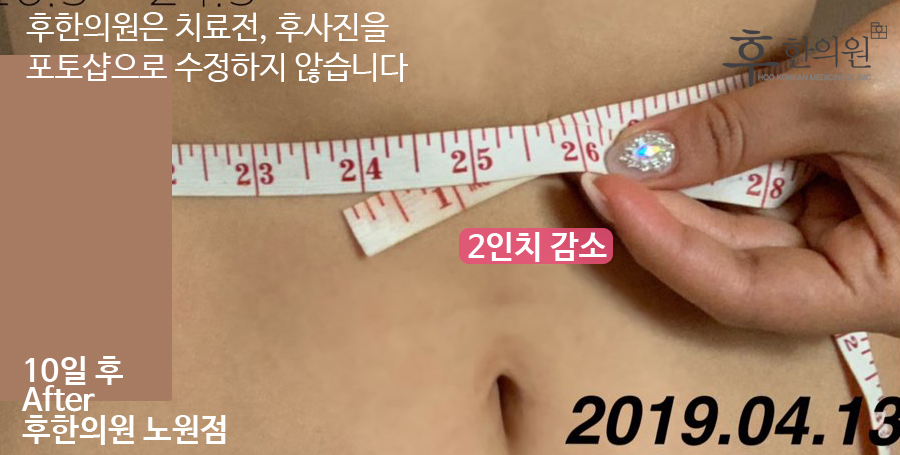 전후사진