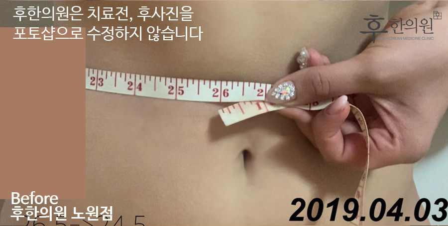 전후사진