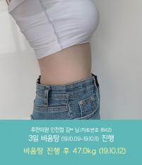 전후사진