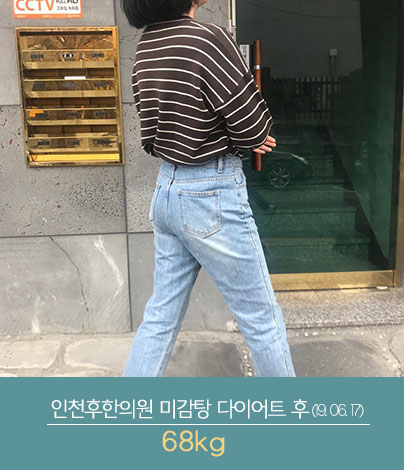 전후사진