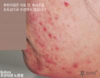 전후사진