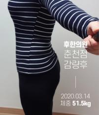 전후사진