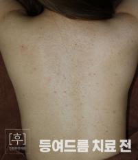 전후사진