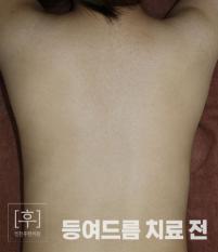 전후사진