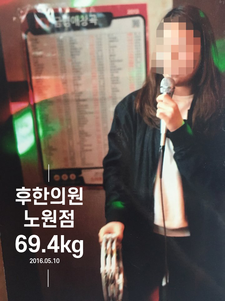 전후사진