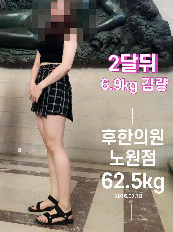 전후사진