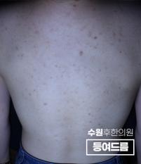 전후사진