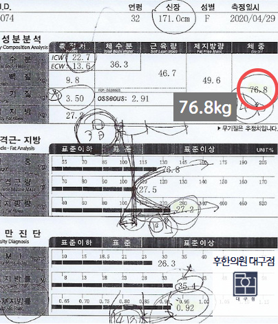 전후사진