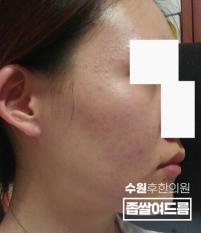 전후사진