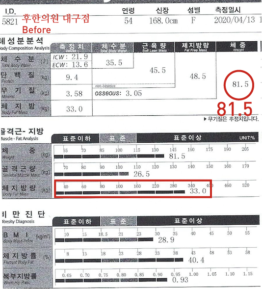전후사진