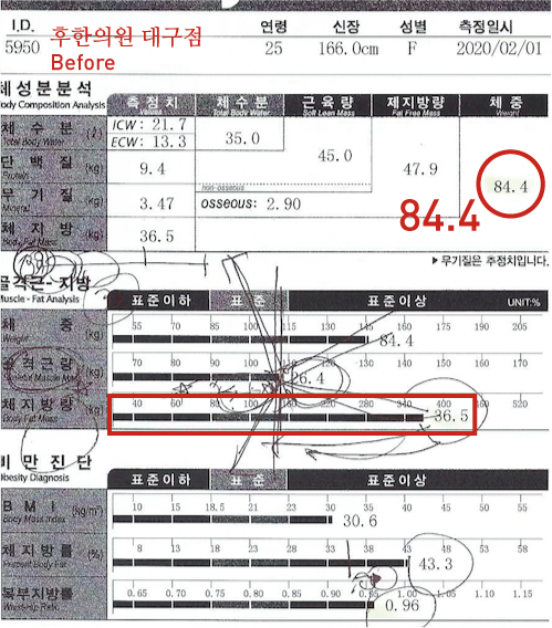 전후사진