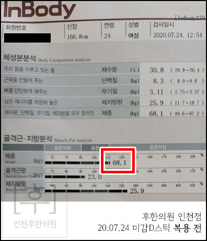 전후사진