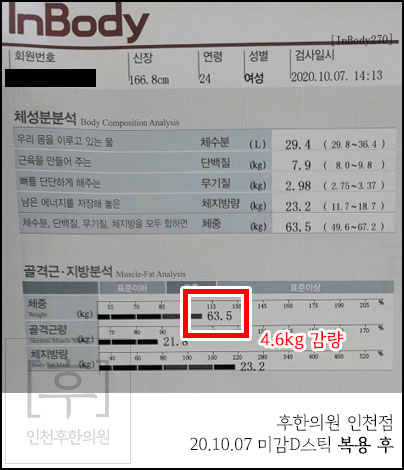 전후사진