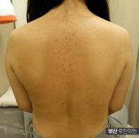 전후사진