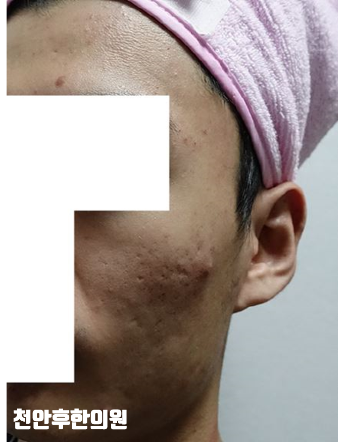 전후사진