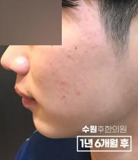 전후사진