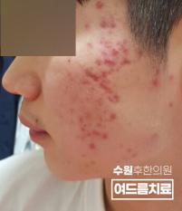 전후사진