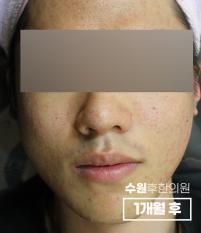 전후사진