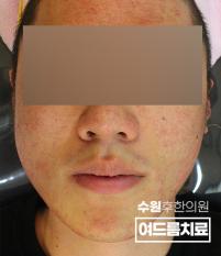 전후사진