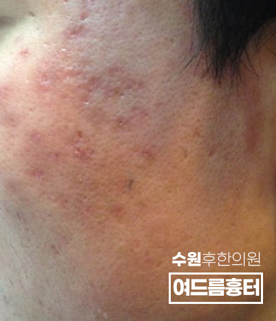 전후사진