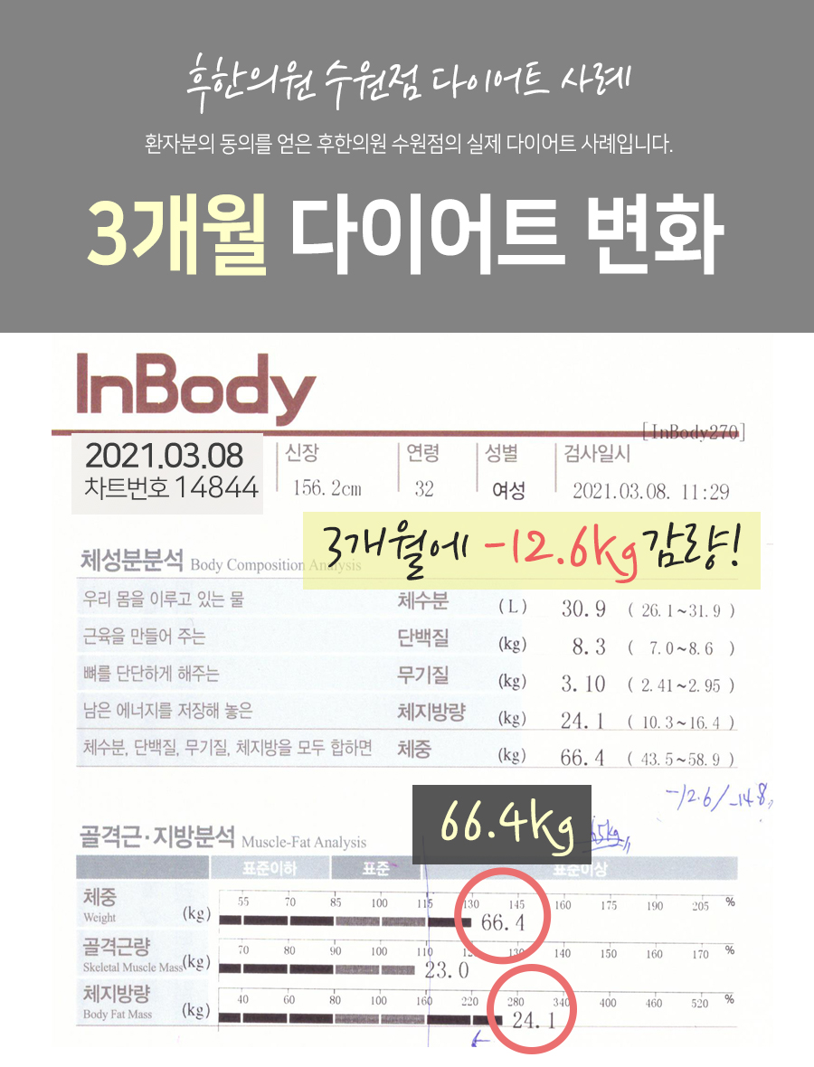 전후사진