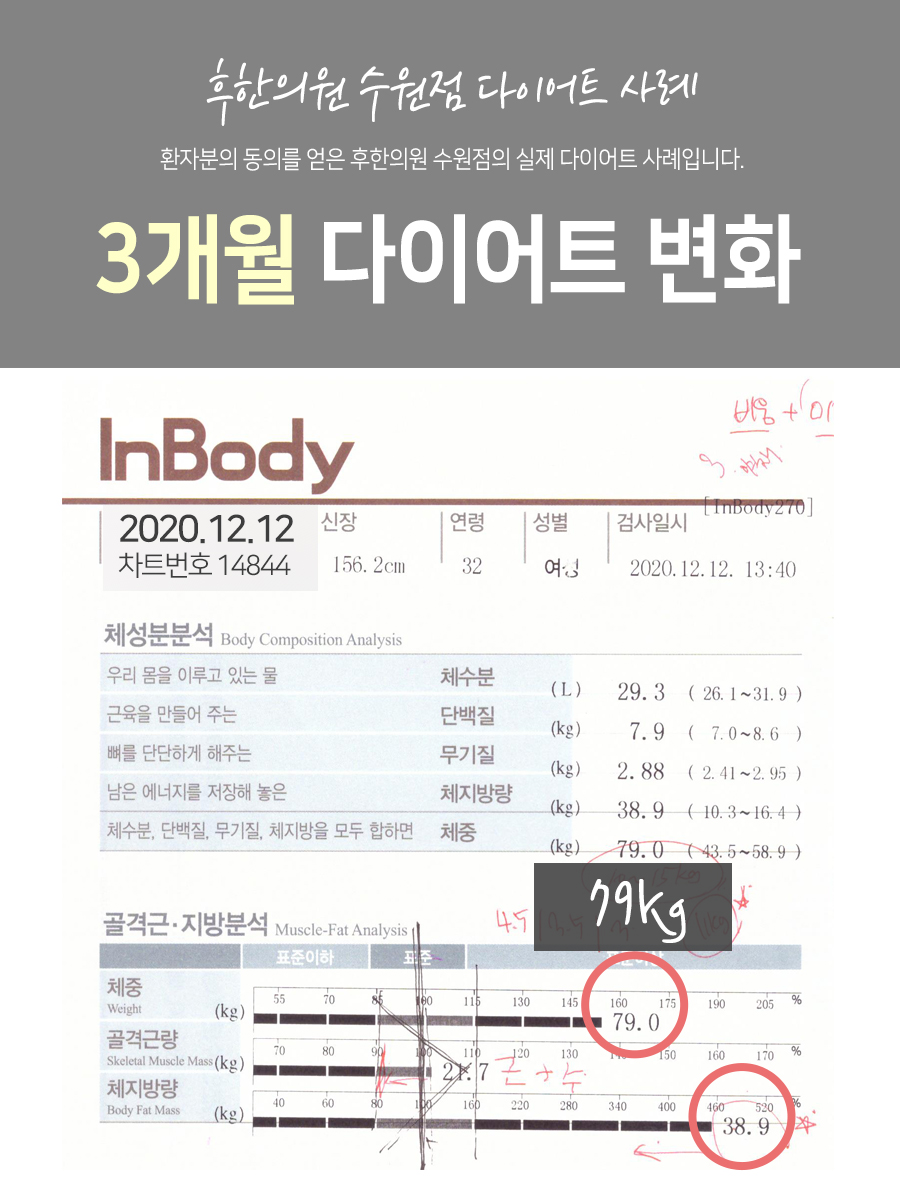 전후사진